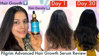 How I Went From Thin To Thick Hair In 30 Days  Pilgrim Advanced Hair Growth Serum Review [upl. by Benjamen45]