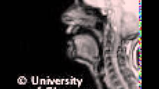 MRI voiced pharyngeal fricative [upl. by Lada]