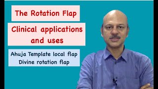 Localflaps Advancement flaps [upl. by Boothman]