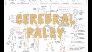 Cerebral Palsy  DETAILED Overview [upl. by Oigroeg]