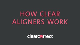 How clear aligners work [upl. by Penthea]