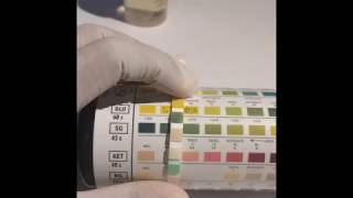 UTI dipstick test Urine Analysis [upl. by Nylegna]