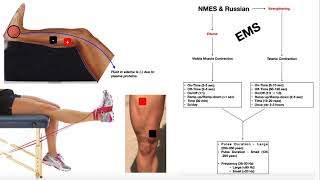 Somatic vs Autonomic Nervous System  Physiology [upl. by Ielirol691]