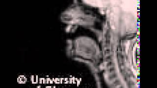 MRI voiceless alveolar lateralfricative [upl. by Ynahpit]