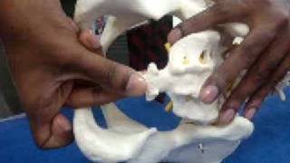 Dr P Senthil Kumar PhD PT Coccyx Mobilization Technique Maitlands Concept for Coccydynia [upl. by Fillender67]