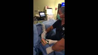 TENEX surgery for Golfers Elbow Epicondylitis by Dr Alejandro Badia [upl. by Anival]