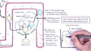 Epstein Barr Virus and Infectious Mononucleosis pathophysiology investigations and treatment [upl. by Jodee]