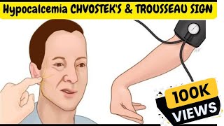 Hypocalcemia Signs and Symptoms  CHVOSTEKS amp TROUSSEAU SIGN [upl. by Mira495]