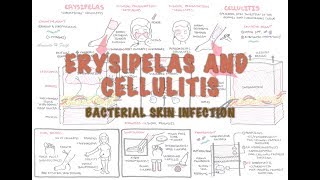 Bacterial Skin Infection  Cellulitis and Erysipelas Clinical Presentation Pathology Treatment [upl. by Boucher659]