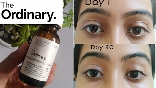 The Ordinary Caffeine Solution 5  EGCG for Dark Circles Review [upl. by Ankeny]