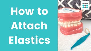 HOW TO PUT ELASTICS ON CLEAR ALIGNERS l Dr Melissa Bailey [upl. by Kelli597]