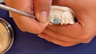 Encerado de un primer molar superior FACIL Paso a paso  upper first molar wax up [upl. by Valentine]