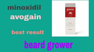 avogain using in 3months honest reviewshort clip minoxidilavogain2021 [upl. by Iris290]