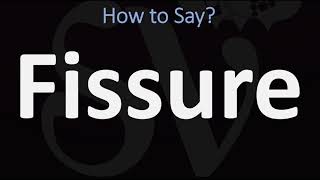 How to Pronounce Fissure CORRECTLY [upl. by Kanor225]