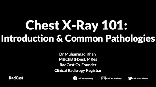 RadCast Academy Introduction To The Chest XRay amp Common Pathologies cxr radcast [upl. by Takashi488]