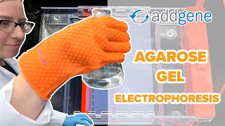 Agarose Gel Electrophoresis [upl. by Amann591]