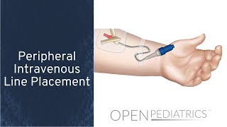 Peripheral Intravenous Line Placement by B Johnson L DelSignore  OPENPediatrics [upl. by Lauzon]