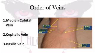 Phlebotomy The Order of Veins [upl. by Hsaka]