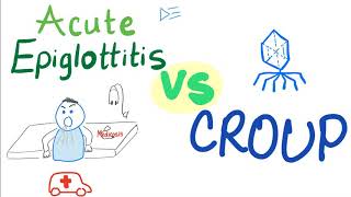 Acute Epiglottitis Vs Croup  A Detailed Comparison [upl. by Asilam452]