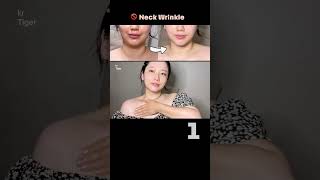 38세 셀프경락 얼굴의 뿌리 쇄골에 영양 수분 산소를 Neck wrinkles removal [upl. by Cardinal]