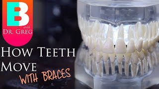 BRACES EXPLAINED How Teeth Move  Braces Work [upl. by Lindsey735]