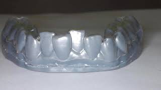 Clear Aligners 3D Printed by Nirenblatt Orthodontics [upl. by Ebocaj748]