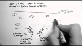 Haemostasis 1  Clots Thrombi amp Antiplatelets [upl. by Cara]