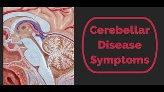 Cerebellar Disease Symptoms [upl. by Michel]