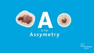 Draining a subungual hematoma [upl. by Yrallih]