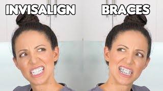 Braces or Invisalign Which is BETTER [upl. by Apul]