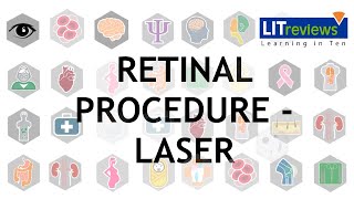 Common Retinal Procedure Laser [upl. by Ahseyt893]