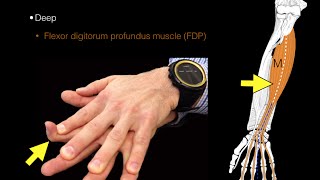 Forearm flexor muscles [upl. by Amalburga]