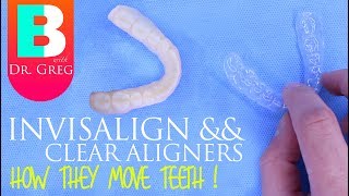 How Invisalign Works  How Clear Aligners Work [upl. by Arleen]