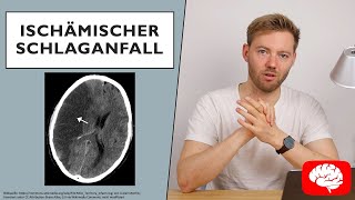 Ischämischer Schlaganfall  Grundlagen der Neurologie [upl. by Tolley]