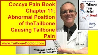 Chapter 11 Abnormal Coccyx Position Causing Tailbone Pain Coccyx Pain [upl. by Anelet]