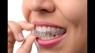 Clear aligners  Lapointe Dental Centres [upl. by Yenttirb741]