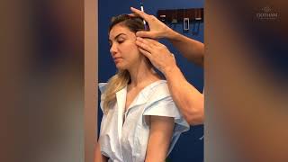 Ponytail Micro Lift Procedure by Dr Miller [upl. by Muffin811]