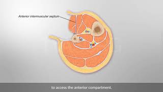 Posterior Pharyngeal Flap to Treat VPI [upl. by Judie]