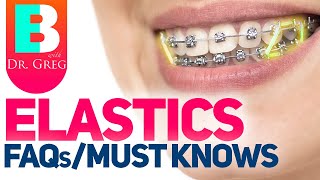 Braces Elastics  Rubber Bands – 5 Most Common Questions [upl. by Jeanna]