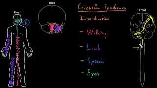 Syndrome Cerebellar syndromes [upl. by Berners697]