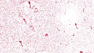 Microbiology of Malaria a Protozoan Disease [upl. by Everick97]