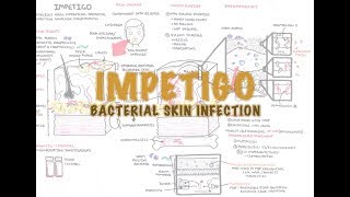 Impetigo Bacterial Skin Infection  Overview Clinical Presentation Pathophysiology Treatment [upl. by Poree36]