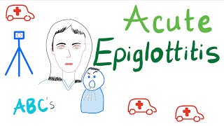 Acute Epiglottitis  Causes Symptoms Diagnosis and Management [upl. by Yror]