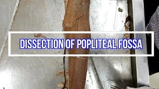 Dissection of Popliteal Fossa [upl. by Maillij89]