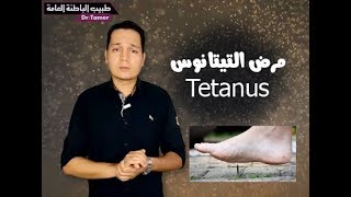 التيتانوس  Tetanus [upl. by Schultz]